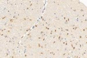 Immunohistochemistry (Paraffin-embedded Sections) (IHC (p)) image for anti-Growth Differentiation Factor 6 (GDF6) antibody (ABIN7074132)