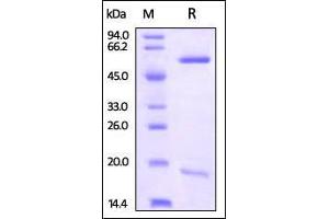SDS-PAGE (SDS) image for Proprotein Convertase Subtilisin/kexin Type 9 (PCSK9) (AA 31-692) (Active) protein (His tag) (ABIN2870794)