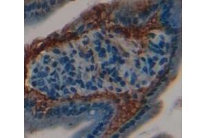 Figure. (Connexin 31 antibody  (AA 213-270))
