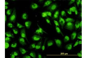 Immunofluorescence of monoclonal antibody to DHX9 on HeLa cell. (DHX9 antibody  (AA 1-90))