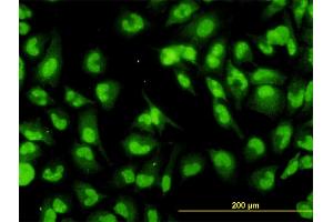 Immunofluorescence of monoclonal antibody to DHX9 on HeLa cell.