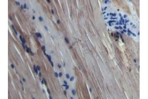 Detection of MYO in Bovine Skeletal muscle Tissue using Polyclonal Antibody to Myoglobin (MYO) (Myoglobin antibody  (AA 1-154))