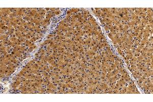 Immunohistochemistry (IHC) image for anti-Signal Transducer and Activator of Transcription 2, 113kDa (STAT2) (AA 616-849) antibody (ABIN7434083)