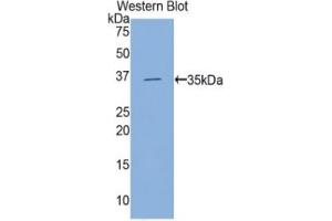 WB of Protein Standard: different control antibodies against Highly purified E. (Hexokinase 2 ELISA Kit)