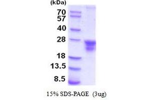 SDS-PAGE (SDS) image for HLA-DR-gamma (CD74) (AA 73-232) protein (His tag) (ABIN5854298)