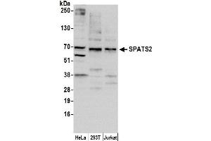 anti-Spermatogenesis Associated, Serine-Rich 2 (SPATS2) (AA 495-545) antibody