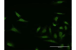 Immunofluorescence of monoclonal antibody to MKNK1 on HeLa cell.