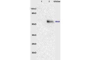 Lane 1: mouse lung lysates Lane 2: human colon carcinoma lysates probed with Anti-NRF-1 Polyclonal Antibody, Unconjugated (ABIN675219) at 1:200 in 4 °C. (NRF1 antibody  (AA 51-180))