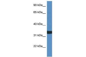 WB Suggested Anti-ACER1 Antibody Titration: 1. (ACER1 antibody  (C-Term))
