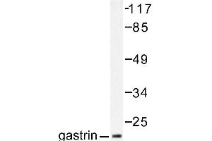 Image no. 2 for anti-Gastrin (GAST) antibody (ABIN265432) (Gastrin antibody)