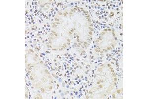 Immunohistochemistry (Paraffin-embedded Sections) (IHC (p)) image for anti-Small Nuclear Ribonucleoprotein Polypeptide A (SNRPA) (AA 1-282) antibody (ABIN6148210)