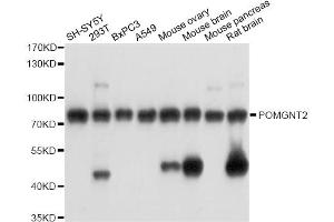 Western blot analysis of extracts of various cell lines, using POMGNT2 antibody (ABIN6289951) at 1:3000 dilution.