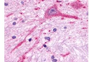 Immunohistochemical staining of Brain (Neurons) using anti- MCHR2 antibody ABIN122241 (MCHR2 antibody)