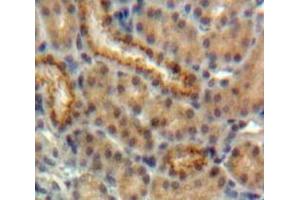 #VALUE! (EPO antibody)