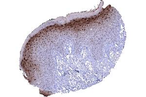 Skin In the skin a nuclear and cytoplasmic Cystatin A immunostaining is predominantly seen in the granular cell layer. (CSTA antibody)