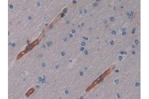 Detection of CYTH2 in Human Cerebrum Tissue using Polyclonal Antibody to Cytohesin 2 (CYTH2) (Cytohesin 2 antibody  (AA 1-390))