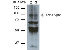 Western Blot analysis of Mouse Whole kidney homogenates showing detection of ~85kDa ENaC alpha protein using Mouse Anti-ENaC alpha Monoclonal Antibody, Clone 2G4 . (SCNN1A antibody  (AA 46-68) (PerCP))