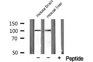 Western blot analysis on HuvEc cell lysate using NARG1 Antibody (NAA15 antibody  (Internal Region))