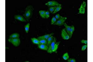 Immunofluorescence (IF) image for anti-SKI-Like Oncogene (SKIL) (AA 359-579) antibody (ABIN7169773)