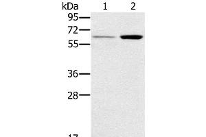 Western Blot analysis of Human liver and Mouse kidney tissue using TNFRSF11A Polyclonal Antibody at dilution of 1:200 (TNFRSF11A antibody)