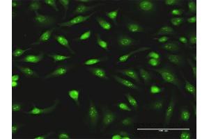 Immunofluorescence of monoclonal antibody to PCYT1A on HeLa cell.