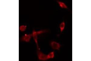 ABIN6275430 staining  HepG2 cells by IF/ICC. (PDK2 antibody  (Internal Region))