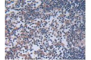 IHC-P analysis of Rat Lymph Node Tissue, with DAB staining. (IL12A antibody  (AA 23-215))
