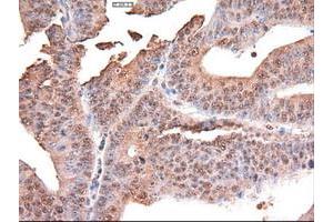 Image no. 10 for anti-Myc Proto-Oncogene protein (MYC) antibody (ABIN1497012) (c-MYC antibody)