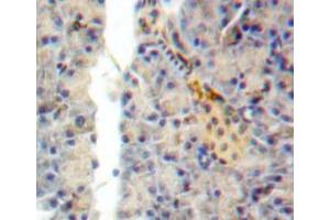 Used in DAB staining on fromalin fixed paraffin-embedded pancreas tissue (SEMA7A antibody  (AA 318-566))