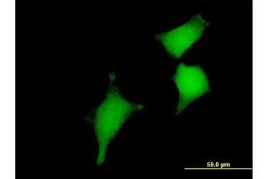 Immunofluorescence of purified MaxPab antibody to GLRX2 on HeLa cell.
