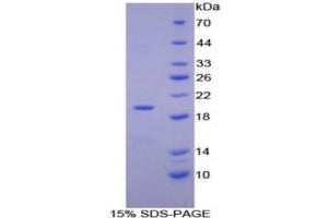 SDS-PAGE (SDS) image for Ectonucleotide Pyrophosphatase/phosphodiesterase 1 (ENPP1) (AA 362-518) protein (His tag) (ABIN1879583) (ENPP1 Protein (AA 362-518) (His tag))