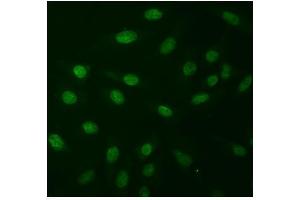 anti-Natriuretic Peptide Receptor A/guanylate Cyclase A (Atrionatriuretic Peptide Receptor A) (NPR1) (AA 58-501) antibody