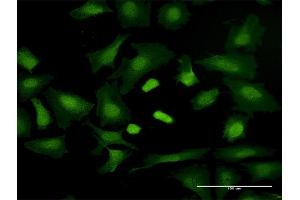 Immunofluorescence of purified MaxPab antibody to TRGV3 on HeLa cell. (TRGV3 antibody  (AA 1-200))