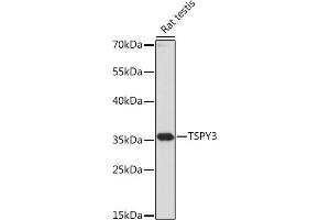 Western blot analysis of extracts of Rat testis, using TSPY3 antibody (ABIN7270776) at 1:1000 dilution. (TSPY3 antibody  (AA 1-308))