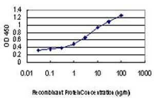 Detection limit for recombinant GST tagged DAPK1 is approximately 0. (DAP Kinase 1 antibody  (AA 1211-1310))