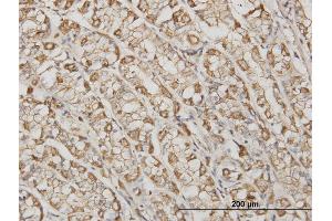 Immunoperoxidase of monoclonal antibody to ACTB on formalin-fixed paraffin-embedded human stomach. (beta Actin antibody  (AA 1-375))