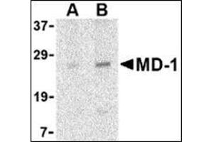 Western blot analysis of MD-1 in Daudi cell lysate with this product at (A) 1 and (B) 2 μg/ml. (LY86 antibody  (Center))