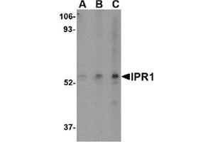 Western blot analysis of IPR1 in Hela cell lysate with IPR1 antibody at (A) 0.