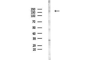 anti-Lysine (K)-Specific Demethylase 5A (KDM5A) (C-Term) antibody