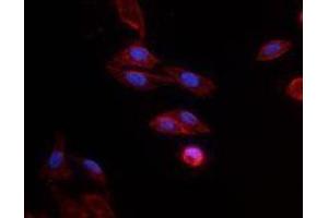 Immunofluorescence (IF) image for Goat anti-Mouse IgG antibody (Alexa Fluor 594) (ABIN2667003) (Goat anti-Mouse IgG Antibody (Alexa Fluor 594))