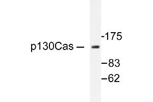 Image no. 1 for anti-Breast Cancer Anti-Estrogen Resistance 1 (BCAR1) antibody (ABIN271903) (BCAR1 antibody)