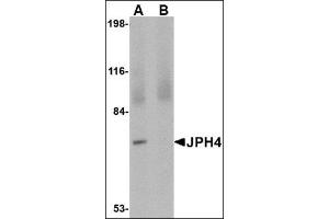 Western blot analysis of JPH4 in 293 cell lysate with this product at 1 μg/ml in (A) the absence and (B) the presence of blocking peptide.