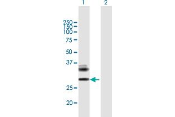 Retinoic Acid Early Transcript 1E (RAET1E) (AA 1-263) antibody