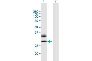 Western Blot analysis of RAET1E expression in transfected 293T cell line by RAET1E MaxPab polyclonal antibody.