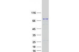 Western Blotting (WB) image for DEXH (Asp-Glu-X-His) Box Polypeptide 58 (DHX58) protein (Myc-DYKDDDDK Tag) (ABIN2719466)