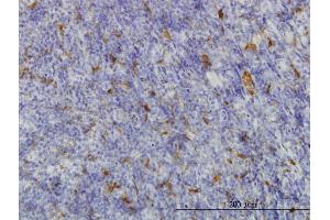 Immunoperoxidase of monoclonal antibody to ME1 on formalin-fixed paraffin-embedded human tonsil. (ME1 antibody  (AA 1-572))