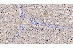 Detection of IL29 in Human Liver Tissue using Monoclonal Antibody to Interleukin 29 (IL29) (IL29 antibody  (AA 20-200))