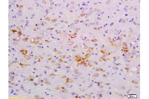 Formalin-fixed and paraffin embedded rat brain labeled with Anti-NFkB Inducing Kinase NIK Polyclonal Antibody, Unconjugated (ABIN724520) at 1:200 followed by conjugation to the secondary antibody and DAB staining