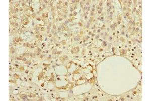 Immunohistochemistry of paraffin-embedded human adrenal gland tissue using ABIN7144926 at dilution of 1:100 (ABCF3 antibody  (AA 201-500))