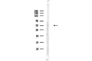 Western blot analysis of lysates from Hela cells(heat-shock,45 min treatment), using MRPS30 Antibody at 1/1000 dilution.